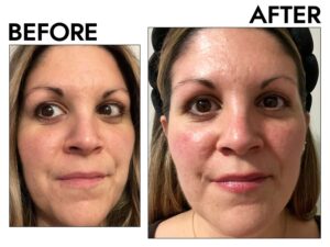 byr-anti-aging-serums-test-dennis-gross-advanced-retinol-ferric-texture-renewal-before-after-karah-rosa-53073aef97c04a8aa45d4acd5a17dc9e