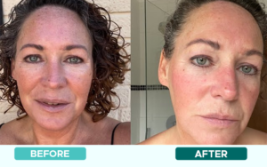 BEFORE AFTER 1