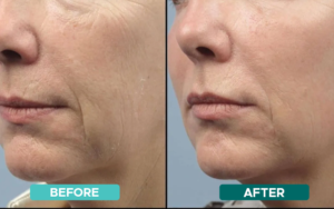 BEFORE AFTER 2