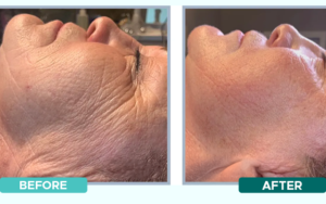 BEFORE AFTER 3