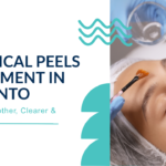 Chemical Peels Treatment in Toronto
