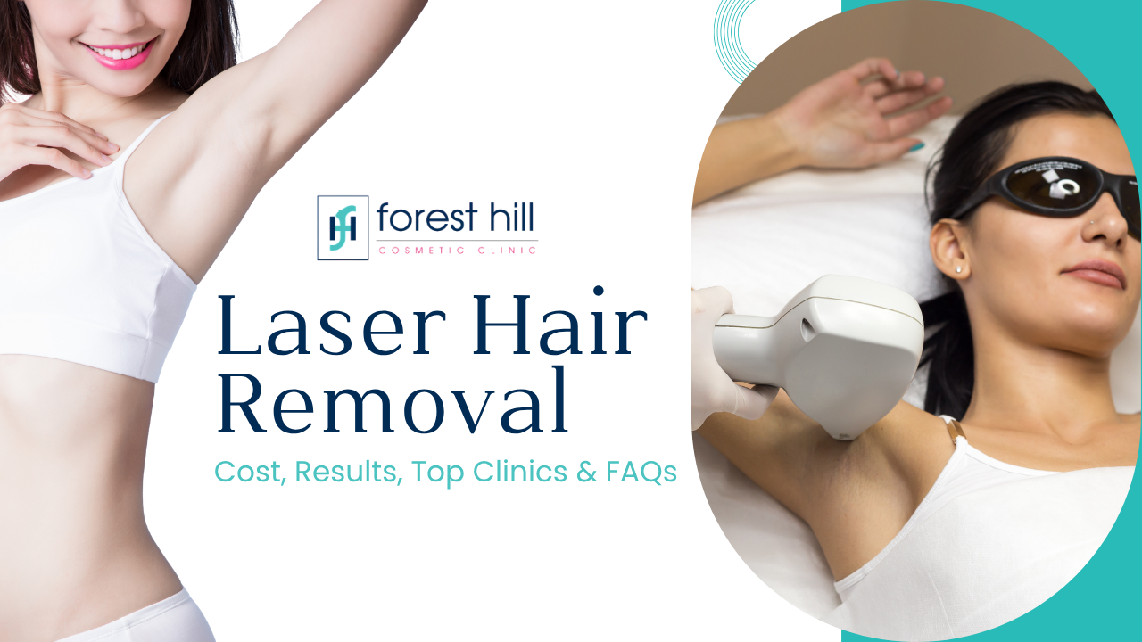 Laser hair removal