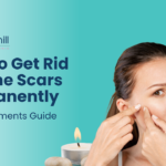 How to Remove Acne Scars