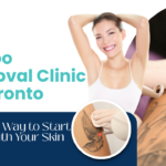 Tattoo Removal Clinic in Toronto