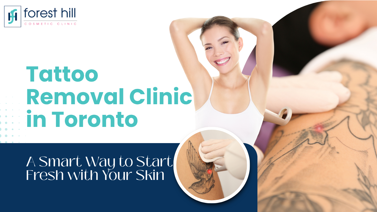 Tattoo Removal Clinic in Toronto